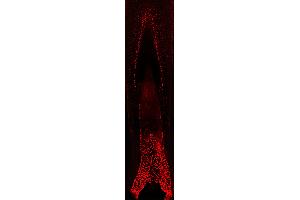 human hair follicle (courtesy of L. (HOXC13 antibody)