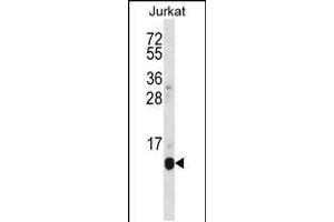 Western blot analysis in Jurkat cell line lysates (35ug/lane). (POLR2G antibody  (C-Term))