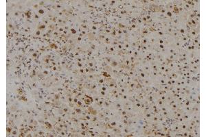ABIN6278938 at 1/100 staining Mouse liver tissue by IHC-P. (MYST3 antibody  (N-Term))