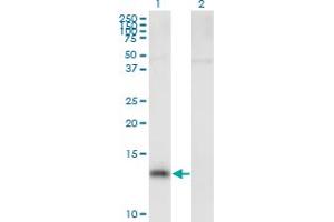 Western Blot analysis of NPHP1 expression in transfected 293T cell line by NPHP1 MaxPab polyclonal antibody.