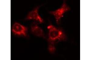 ABIN6275626 staining HepG2 cells by IF/ICC. (CCT6A antibody  (Internal Region))