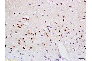 Formalin-fixed and paraffin embedded mouse brain labeled with Anti-Sema3A Polyclonal Antibody, Unconjugated  at 1:200 followed by conjugation to the secondary antibody and DAB staining. (SEMA3A antibody  (AA 22-120))