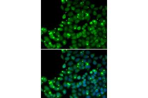 Immunofluorescence analysis of U2OS cells using MGMT antibody (ABIN5970267). (MGMT antibody)