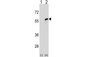 Western Blotting (WB) image for anti-Cell Division Cycle 20 Homolog (S. Cerevisiae) (CDC20) antibody (ABIN3004047) (CDC20 antibody)