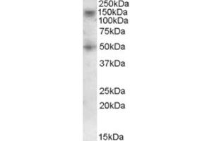 Western Blotting (WB) image for anti-Ring Finger Protein 139 (RNF139) (C-Term) antibody (ABIN2466775)