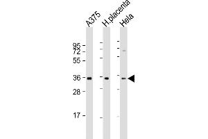 All lanes : Anti-FGF5 Antibody (N-Term) at 1:2000 dilution Lane 1:  whole cell lysate Lane 2: human placenta lysate Lane 3: Hela whole cell lysate Lysates/proteins at 20 μg per lane. (FGF5 antibody  (AA 140-172))