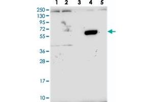 Western blot analysis of Lane 1: RT-4, Lane 2: U-251 MG, Lane 3: Human Plasma, Lane 4: Liver, Lane 5: Tonsil with ZNF837 polyclonal antibody  at 1:250-1:500 dilution.
