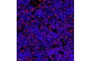 Immunofluorescence of paraffin embedded rat thymus using Skar (ABIN7074970) at dilution of 1:950 (400x lens) (p46 antibody)