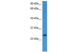Western Blot showing RHOG antibody used at a concentration of 1-2 ug/ml to detect its target protein. (RHOG antibody  (C-Term))
