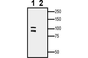 1.