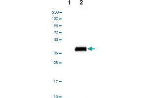 Western blot analysis of Lane 1: Negative control (vector only transfected HEK293T lysate), Lane 2: Over-expression lysate (Co-expressed with a C-terminal myc-DDK tag (~3. (SULT4A1 antibody)
