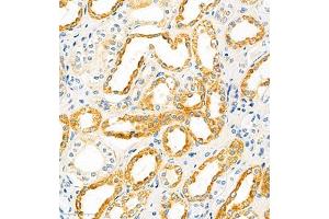 Immunohistochemistry of paraffin embedded human kidney using SLC22A12 (ABIN7075662) at dilution of 1:2100 (300x lens)