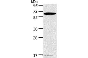 Western blot analysis of Mouse brain tissue, using HMGCS2 Polyclonal Antibody at dilution of 1:200