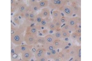 IHC-P analysis of Human Tissue, with DAB staining. (CCL16 antibody  (AA 20-120))