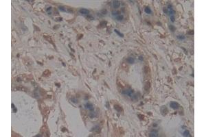 Immunohistochemistry (IHC) image for anti-Nucleoporin 210kDa (NUP210) (AA 1288-1449) antibody (ABIN7442474)