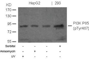 Image no. 1 for anti-Phosphoinositide 3 Kinase, p85 alpha (PI3K p85a) (pTyr467) antibody (ABIN372743) (PIK3R1 antibody  (pTyr467))