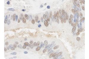 anti-Cleavage Stimulation Factor, 3' Pre-RNA, Subunit 2, 64kDa, tau Variant (CSTF2T) (AA 566-616) antibody