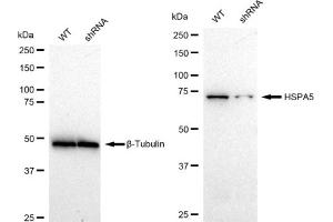 Western blotting analysis using HSPA5 antibody (ABIN7798856).