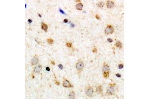 Immunohistochemical analysis of GPR126 staining in human brain formalin fixed paraffin embedded tissue section. (G Protein-Coupled Receptor 126 antibody)