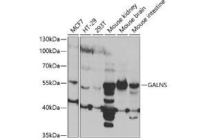 Western blot analysis of extracts of various cell lines, using GALNS antibody (ABIN6131691, ABIN6140937, ABIN6140938 and ABIN6221120) at 1:1000 dilution. (GALNS antibody  (AA 353-522))