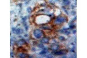 #VALUE! (CD166 antibody  (AA 28-527))