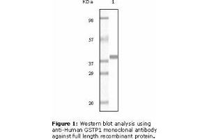 Image no. 2 for anti-Glutathione S-Transferase pi 1 (GSTP1) antibody (ABIN207627) (GSTP1 antibody)