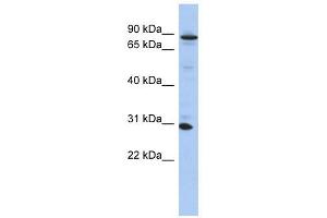 ANKRD47 antibody used at 1 ug/ml to detect target protein. (KANK3 antibody  (N-Term))