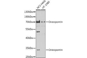 Western blot analysis of extracts of various cell lines, using Osteopontin antibody (ABIN6132293, ABIN6148377, ABIN6148379 and ABIN6218289) at 1:1000 dilution. (Osteopontin antibody  (AA 106-205))