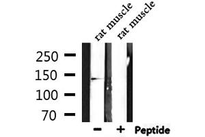 Western blot analysis of extracts from rat muscle, using RNF123 Antibody. (RNF123 antibody  (N-Term))