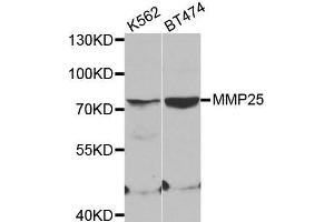 Western blot analysis of extracts of various cell lines, using MMP25 antibody. (MMP25 antibody)