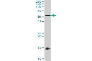 Western Blotting (WB) image for anti-Transforming Growth Factor beta 1 Induced Transcript 1 (TGFB1I1) (AA 1-444) antibody (ABIN520872)