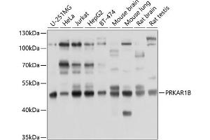 Western blot analysis of extracts of various cell lines, using PRKB antibody (ABIN6130039, ABIN6146193, ABIN6146194 and ABIN6214262) at 1:1000 dilution.