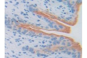 Immunohistochemistry (IHC) image for anti-Activating Transcription Factor 6 (ATF6) (AA 1-377) antibody (ABIN7440587)