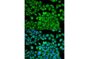 Immunofluorescence analysis of MCF-7 cells using FABP1 antibody (ABIN5973056). (FABP1 antibody)