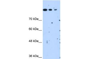 Human HepG2 cells SETD2 is strongly supported by BioGPS gene expression data to be expressed in Human HepG2 cells (SETD2 antibody  (N-Term))