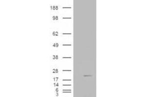 HEK293 overexpressing Human Muscle Cofilin 2 (ABIN5398356) and probed with ABIN185454 (mock transfection in first lane). (Cofilin 2 antibody  (C-Term))
