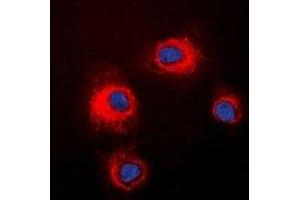 Immunofluorescent analysis of STMN1 (pS16) staining in HeLa cells.