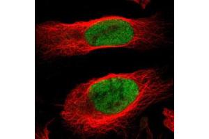 Immunofluorescent staining of U-2 OS with MCM4 polyclonal antibody  (Green) shows positivity in nucleus but excluded from the nucleoli. (MCM4 antibody)