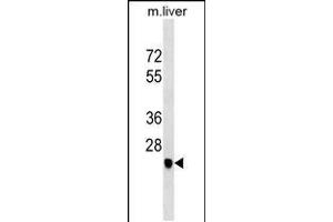Western blot analysis in mouse liver tissue lysates (35ug/lane). (SGCD antibody  (C-Term))
