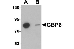Western blot analysis of GBP6 in Hela cell lysate with GBP6 antibody at 0. (GBP6 antibody  (C-Term))