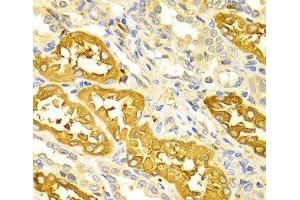Immunohistochemistry of paraffin-embedded Human kidney using BIN1 Polyclonal Antibody at dilution of 1:100 (40x lens). (BIN1 antibody)