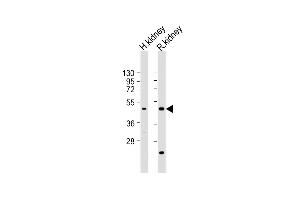 All lanes : Anti-KCNK12 Antibody (C-term) at 1:2000 dilution Lane 1: human kidney lysate Lane 2: rat kidney lysate Lysates/proteins at 20 μg per lane. (KCNK12 antibody  (C-Term))