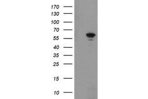 Western Blotting (WB) image for anti-Formiminotransferase Cyclodeaminase (FTCD) antibody (ABIN1496379) (FTCD antibody)
