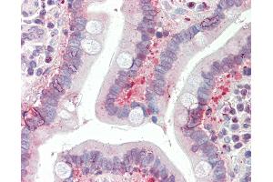 Anti-SLC25A19 antibody IHC staining of human small intestine. (SLC25A19 antibody  (AA 236-263))