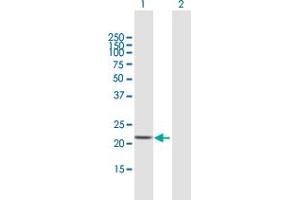 Western Blot analysis of STARD4 expression in transfected 293T cell line by STARD4 MaxPab polyclonal antibody. (STARD4 antibody  (AA 1-205))