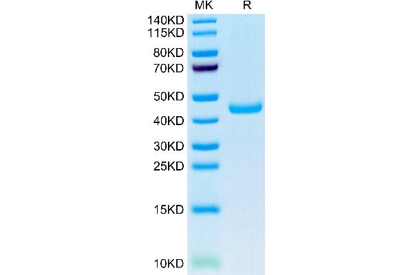 SPARC Protein (AA 18-302) (His tag)