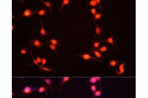 Immunofluorescence analysis of U-251MG cells using S100B Polyclonal Antibody at dilution of 1:100 (20x lens). (S100B antibody)