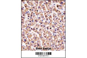HYAL1 Antibody immunohistochemistry analysis in formalin fixed and paraffin embedded human liver tissue followed by peroxidase conjugation of the secondary antibody and DAB staining.