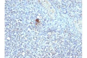 Image no. 1 for anti-TRAcP (Tartarate Resistant Acid Phosphatase) antibody (ABIN6154098) (TRAcP (Tartarate Resistant Acid Phosphatase) antibody)