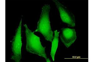 Immunofluorescence of purified MaxPab antibody to UBD on HeLa cell. (UBD antibody  (AA 1-165))